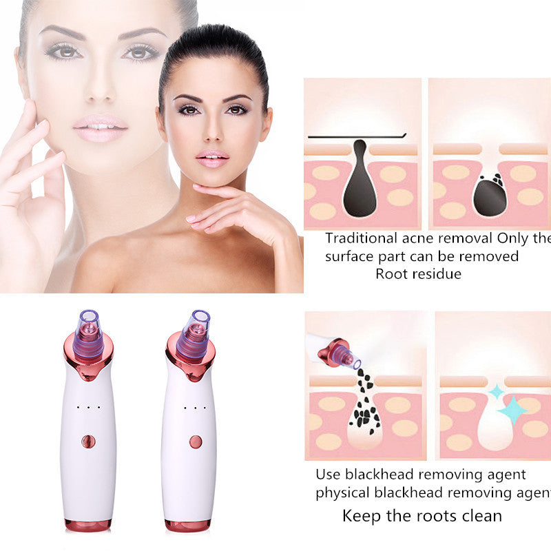 Blackhead Removal Tool