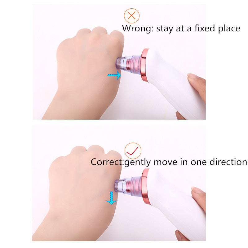 Blackhead Removal Tool