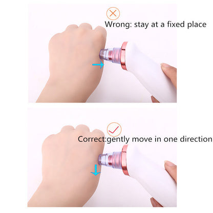 Blackhead Removal Tool